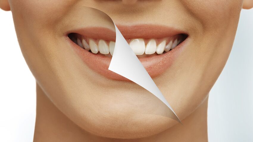 taches-sur-les-dents.jpeg